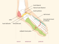 Hallux valgus
